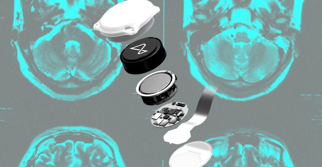 Did Neuralink make the wrong bet?