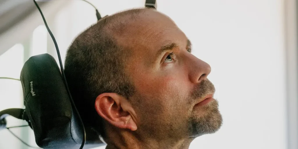 The BCI User Experience: Living With Brain Implants